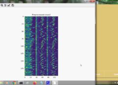 Heart Disease detection from ECG Signal Dataset using Machine learning